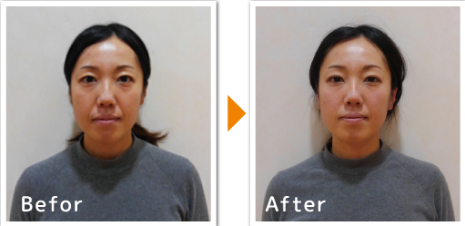 ２０代　女性　Ｓさん画像